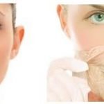 Rejuvenecimiento facial: Elección del tratamiento